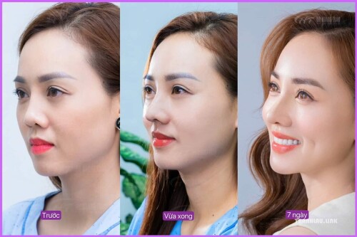 be020ab2bbc99ff4dadeee903d7fc45d.jpg
